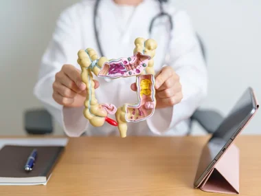 cáncer colon